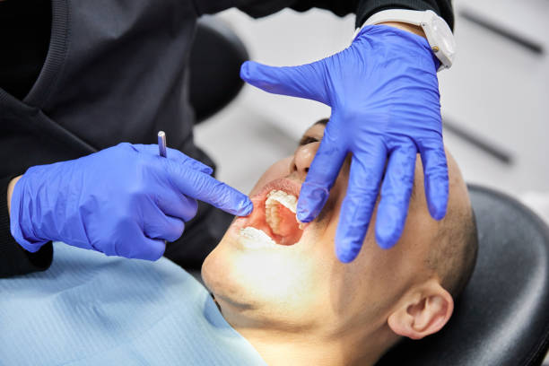 Best Urgent Tooth Repair  in Carrington, ND