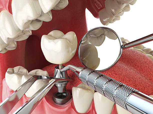 Emergency Dentist Open Today in ND